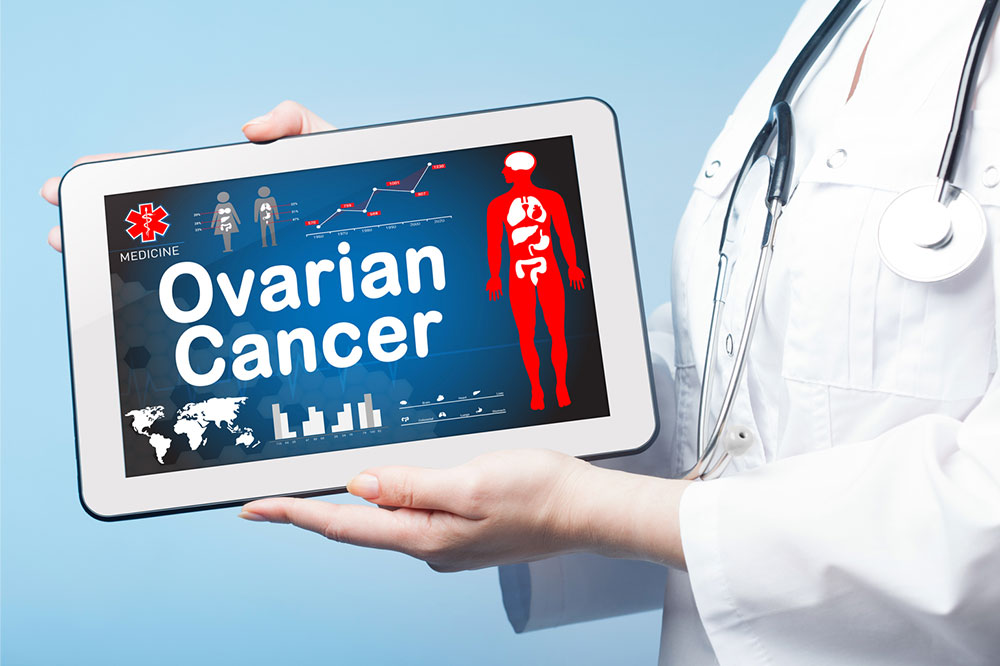 Ovarian cancer &#8211; Early signs and foods that help prevent it