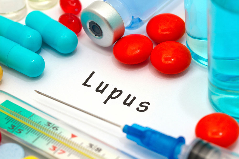 Lupus &#8211; Signs, home remedies, and management