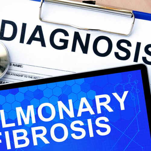 Pulmonary fibrosis &#8211; symptoms, food, and treatment options