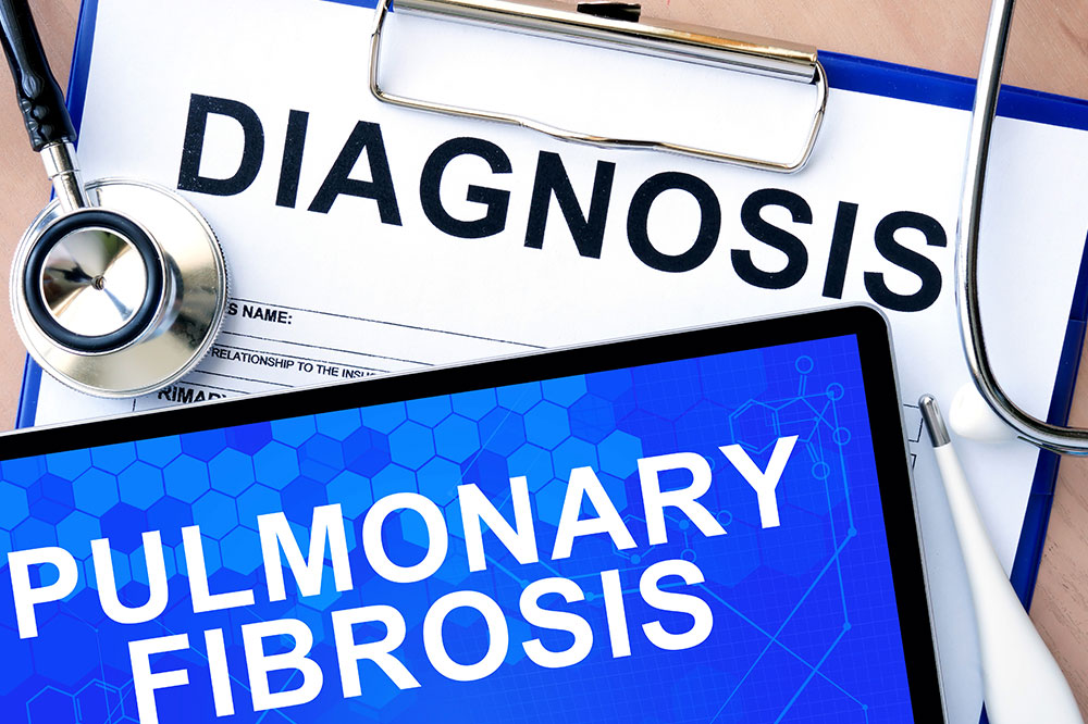 Pulmonary fibrosis &#8211; symptoms, food, and treatment options