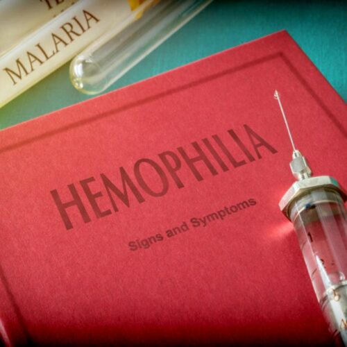 Hemophilia: Types and causes