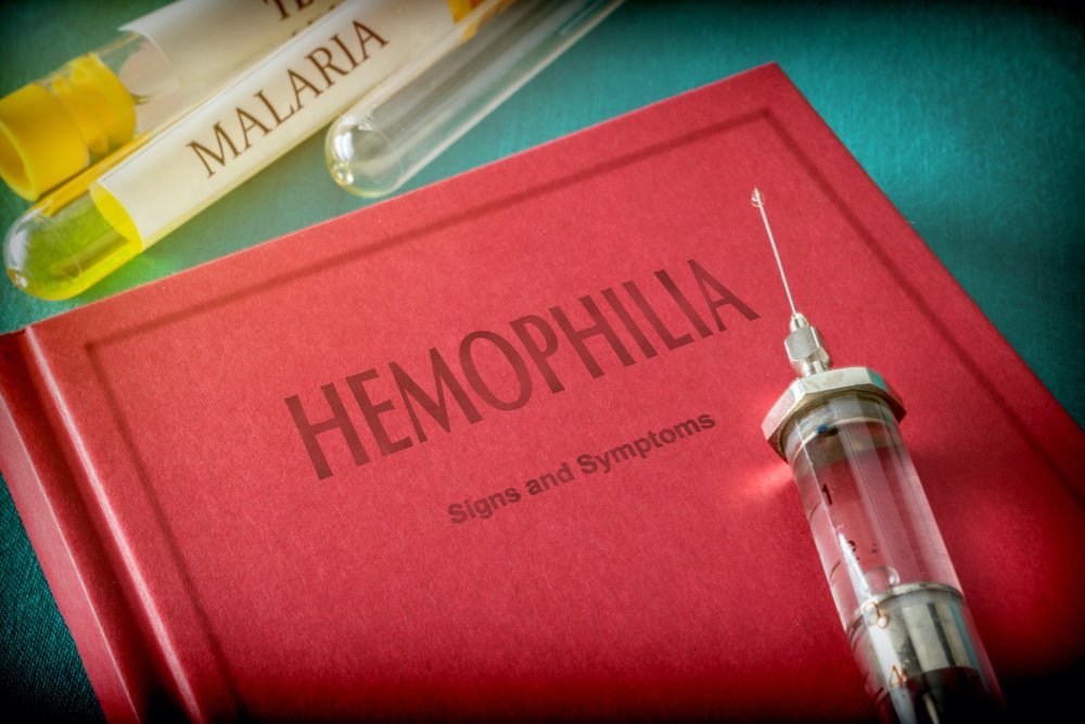 Hemophilia: Types and causes