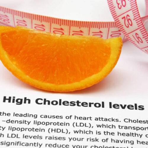 Natural Methods to Reduce Cholesterol Levels