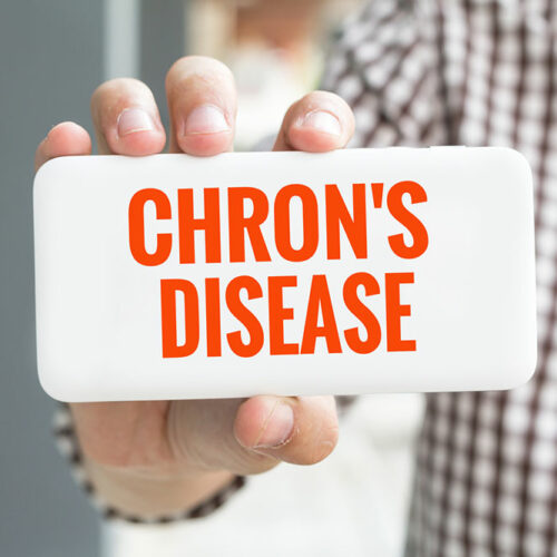 All You Need to Know about Chron&#8217;s disease