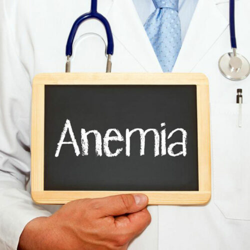 Anemia &#8211; Causes and Symptoms