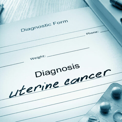 Causes and symptoms of uterine cancer