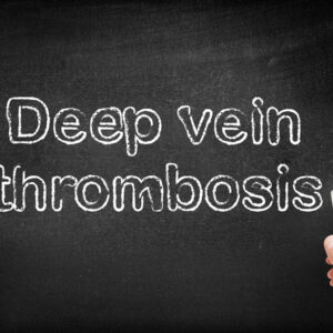 Everything to Know about Deep Vein Thrombosis