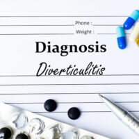 Things to Know about Diverticulitis