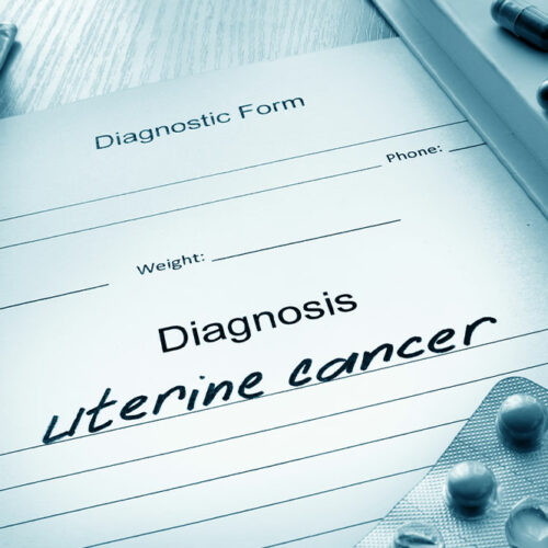 Uterine cancer &#8211; Causes, symptoms, and management