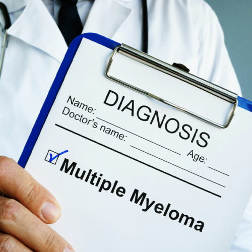 4 early signs of multiple myeloma